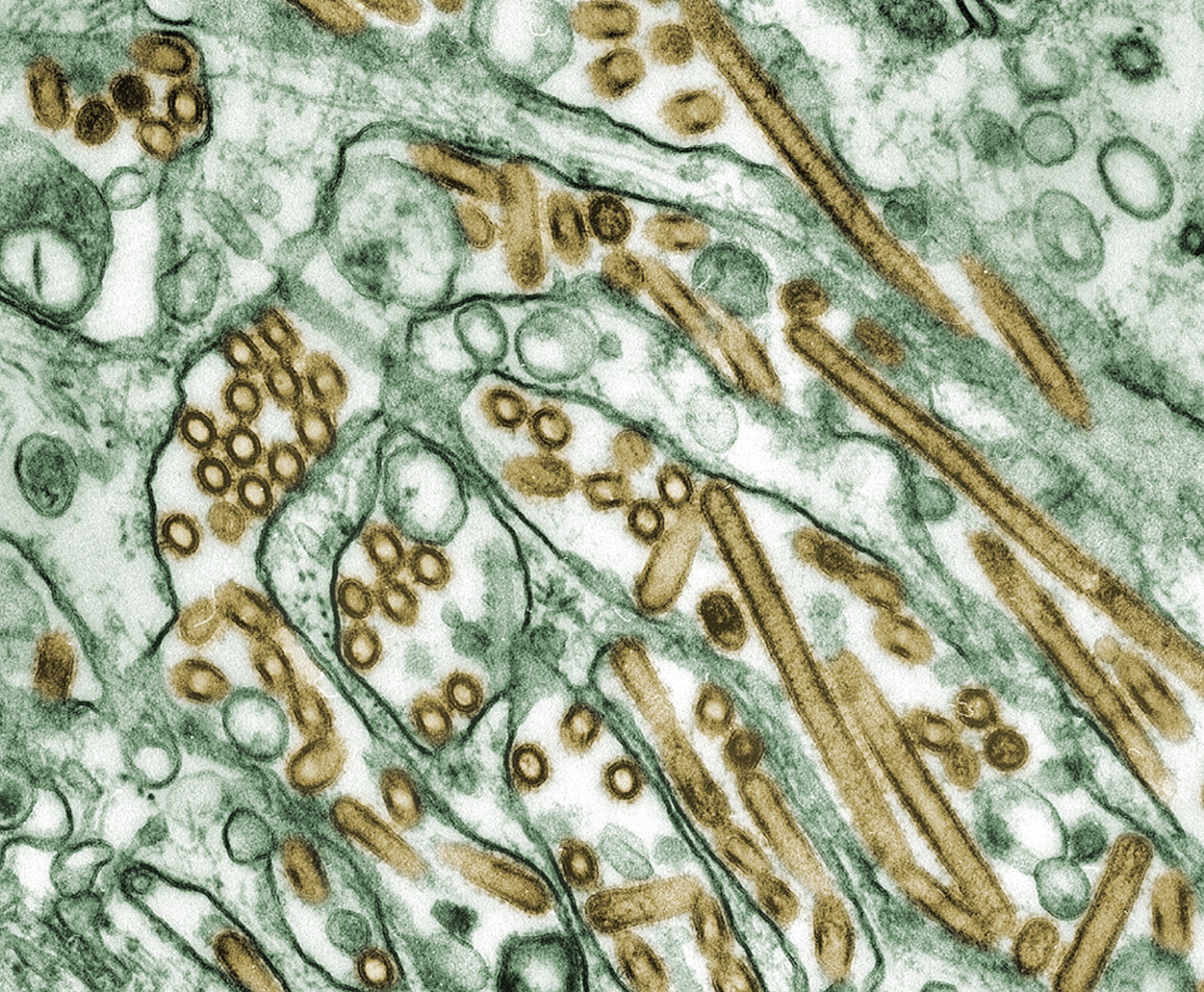 FOTO: Farget transmisjonselektronmikrografi av fugleinfluensa, H5N1-virus (sett i gull) dyrket i MDCK-celler (sett i grønt). 